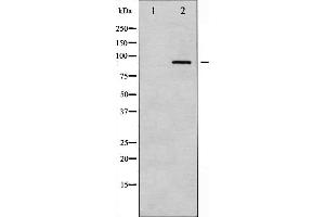Western blot analysis of PKC alpha expression in UV treated NIH-3T3 whole cell lysates,The lane on the left is treated with the antigen-specific peptide.