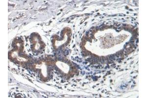 Detection of LEP in Human Breast cancer Tissue using Monoclonal Antibody to Leptin (LEP)