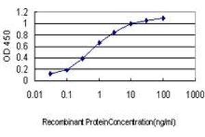 Detection limit for recombinant GST tagged SRPK1 is approximately 0. (SRPK1 anticorps  (AA 371-470))