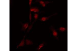 anti-Death Inducer-Obliterator 1 (DIDO1) (C-Term) antibody