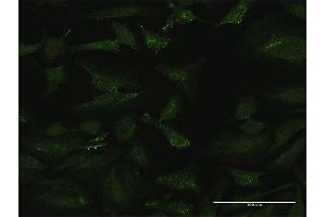 Immunofluorescence of purified MaxPab antibody to CSF3 on HeLa cell.