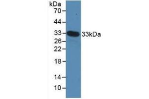 Detection of Recombinant MYH4, Mouse using Polyclonal Antibody to Myosin Heavy Chain 4, Skeletal Muscle (MYH4)