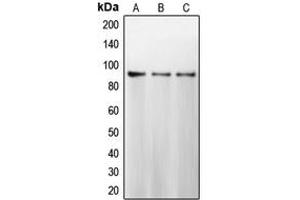 Western blot analysis of Calnexin expression in MCF7 (A), HeLa (B), MDAMB231 (C) whole cell lysates. (Calnexin anticorps  (C-Term))