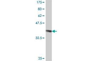 Western Blot detection against Immunogen (37.