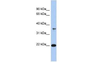 FAIM antibody used at 1 ug/ml to detect target protein. (FAIM anticorps  (N-Term))
