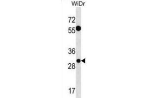 Western Blotting (WB) image for anti-Exosome Component 6 (EXOSC6) antibody (ABIN3000677) (EXOSC6 anticorps)
