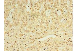 Immunohistochemistry of paraffin-embedded human adrenal gland tissue using ABIN7168458 at dilution of 1:100 (UTP23 anticorps  (AA 1-249))
