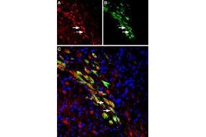 Expression of VMAT2 in rat substantia nigra dopaminergic neurons - Immunohistochemical staining of perfusion-fixed frozen rat brain sections using Anti-VMAT2 Antibody (ABIN7043688, ABIN7044610 and ABIN7044611), (1:1000).