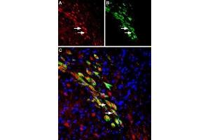Expression of VMAT2 in rat substantia nigra dopaminergic neurons - Immunohistochemical staining of perfusion-fixed frozen rat brain sections using Anti-VMAT2 Antibody (ABIN7043688, ABIN7044610 and ABIN7044611), (1:1000). (SLC18A2 anticorps  (1st Lumenal Region))