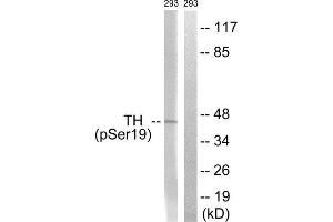 Western Blotting (WB) image for anti-Tyrosine Hydroxylase (TH) (pSer19) antibody (ABIN1847228) (Tyrosine Hydroxylase anticorps  (pSer19))