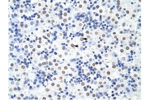 HNRPUL1 antibody was used for immunohistochemistry at a concentration of 4-8 ug/ml to stain Hepatocytes (arrows) in Human Liver.