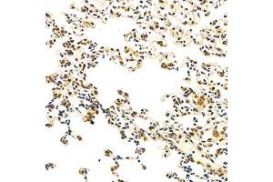 Immunohistochemistry analysis of paraffin-embedded mouse inflammation lung using Eif2ak1 (ABIN7073875) at dilution of 1: 1000 (EIF2AK1 anticorps)