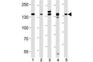 Western blot analysis of lysate from (1) HeLa, (2) MCF-7, (3) mouse C2C12, (4) mouse NIH3T3, (5) rat C6 cell line using Raptor antibody at 1:1000. (RAPTOR anticorps)