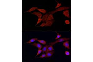 Immunofluorescence analysis of NIH/3T3 cells using DOK4 Rabbit pAb (ABIN3020721, ABIN3020722, ABIN3020723 and ABIN6213691) at dilution of 1:50 (40x lens).