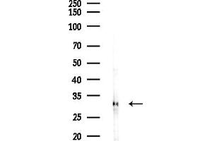 anti-Voltage-Dependent Anion Channel 2 (VDAC2) (C-Term) antibody