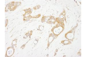 anti-Odd-Skipped Related 1 (OSR1) (AA 375-425) antibody