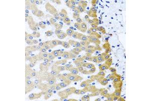 Immunohistochemistry of paraffin-embedded human liver injury using M6PR antibody at dilution of 1:100 (x40 lens). (M6PR anticorps)
