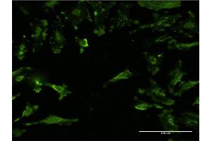 Immunofluorescence of monoclonal antibody to STX4 on HeLa cell.