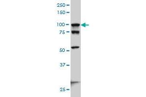 ACTN4 monoclonal antibody (M01), clone 4D10 Western Blot analysis of ACTN4 expression in Hela S3 NE .