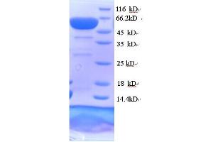 SDS-PAGE (SDS) image for Collapsin Response Mediator Protein 1 (CRMP1) (AA 1-572), (full length) protein (His tag) (ABIN5714348)