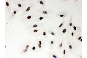 Anti- PARP Picoband antibody, ICC ICC: A549 Cell