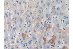 Detection of TARC in Mouse Liver Tissue using Polyclonal Antibody to Thymus Activation Regulated Chemokine (TARC) (CCL17 anticorps  (AA 12-83))