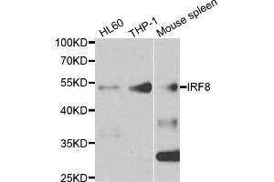 Western blot analysis of extracts of various cell lines, using IRF8 antibody. (IRF8 anticorps)