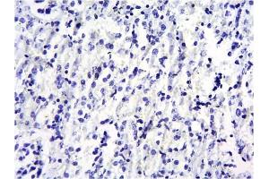 ABIN184575 Negative Control showing staining of paraffin embedded Mouse Kidney, with no primary antibody. (SOCS1 anticorps  (C-Term))