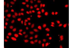 Immunofluorescence analysis of  cells using EP/HIF2α antibody (ABIN6127869, ABIN6141764, ABIN6141765 and ABIN6223457).