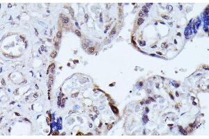 Immunohistochemistry of paraffin-embedded Human placenta using KIAA1429 Polyclonal Antibody at dilution of 1:100 (40x lens).