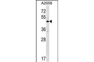 Western blot analysis in A2058 cell line lysates (35ug/lane). (XKR3 anticorps  (C-Term))