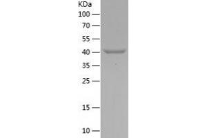 Western Blotting (WB) image for Melanoma Antigen Family A, 3 (MAGEA3) (AA 1-145) protein (His-IF2DI Tag) (ABIN7123886)