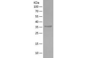 Western Blotting (WB) image for Microtubule-Associated Protein 1 Light Chain 3 beta (MAP1LC3B) (AA 1-107) protein (His-IF2DI Tag) (ABIN7123959)