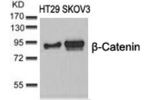 Image no. 3 for anti-Catenin (Cadherin-Associated Protein), beta 1, 88kDa (CTNNB1) (Ser37) antibody (ABIN197447) (CTNNB1 anticorps  (Ser37))