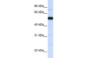 THUMPD2 antibody used at 1 ug/ml to detect target protein. (THUMPD2 anticorps  (N-Term))