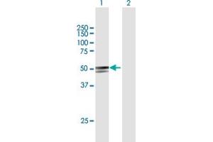 Western Blot analysis of ANKDD1A expression in transfected 293T cell line by ANKDD1A MaxPab polyclonal antibody. (ANKDD1A anticorps  (AA 1-423))