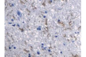DAB staining on IHC-P; Samples: Rat Spinal cord Tissue (RANKL anticorps  (AA 106-240))