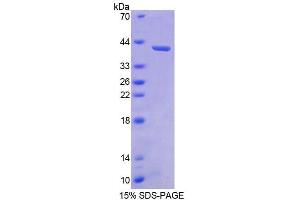 SDS-PAGE analysis of Human BMP3 Protein. (BMP3 Protéine)