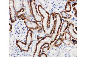 Anti-SLC22A6 antibody, IHC(P) IHC(P): Rat Kidney Tissue