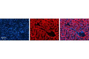 P4HB antibody - C-terminal region          Formalin Fixed Paraffin Embedded Tissue:  Human Liver Tissue    Observed Staining:  Cytoplasm in hepatocytes   Primary Antibody Concentration:  1:100    Secondary Antibody:  Donkey anti-Rabbit-Cy3    Secondary Antibody Concentration:  1:200    Magnification:  20X    Exposure Time:  0.