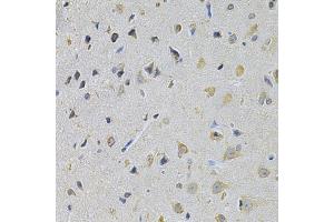 Immunohistochemistry of paraffin-embedded rat brain using PPA1 Antibody (ABIN5971134) at dilution of 1/200 (40x lens). (Pyrophosphatase (Inorganic) 1 (PPA1) anticorps)