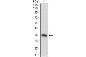 Western blot analysis using CD93 mAb against human CD93 recombinant protein. (CD93 anticorps  (AA 474-535))