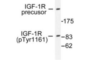 Image no. 1 for anti-Insulin-Like Growth Factor 1 Receptor (IGF1R) (pTyr1161) antibody (ABIN318045) (IGF1R anticorps  (pTyr1161))