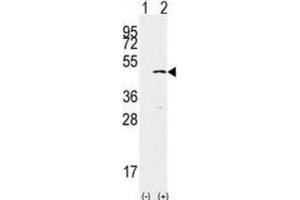 Western Blotting (WB) image for anti-SET Domain Containing 8 Pseudogene 1 (SETD8P1) antibody (ABIN2996451) (SET7 anticorps)