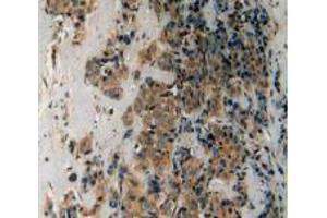 Figure. (LPCAT3 anticorps  (AA 122-233))