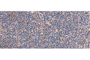 Immunohistochemistry of paraffin-embedded Human tonsil tissue using IP6K2 Polyclonal Antibody at dilution of 1:45(x200)