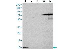 Western blot analysis of Lane 1: RT-4, Lane 2: U-251 MG, Lane 3: Human Plasma, Lane 4: Liver, Lane 5: Tonsil with HIGD1A polyclonal antibody  at 1:250-1:500 dilution. (HIGD1A anticorps)