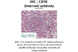 Image no. 1 for anti-CD70 Molecule (CD70) (Internal Region) antibody (ABIN1732875)