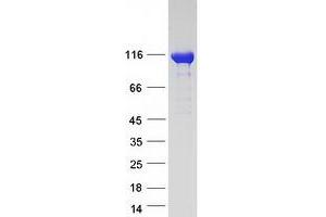 Validation with Western Blot