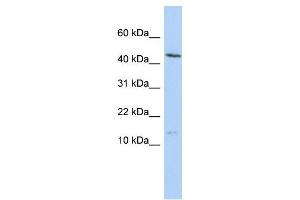 MYL6 antibody used at 1 ug/ml to detect target protein. (MYL6 anticorps  (N-Term))